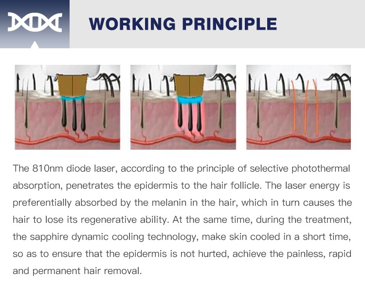 Diode Laser Hair Removal Machine-6.jpg